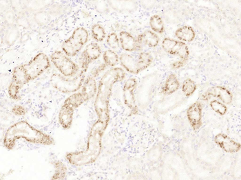 LPHN1 Rabbit Polyclonal Antibody