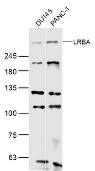 LRBA Rabbit Polyclonal Antibody