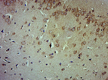 LRIT1 Rabbit Polyclonal Antibody