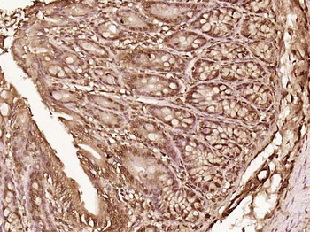 LTV1/C6orf93 Rabbit Polyclonal Antibody