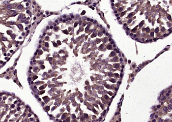 LYZL2 Rabbit Polyclonal Antibody