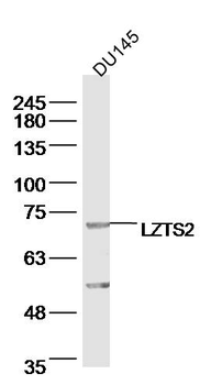LZTS2 Rabbit Polyclonal Antibody
