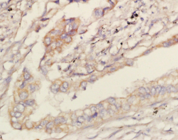 LPCAT2 Rabbit Polyclonal Antibody