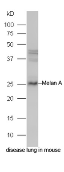 Melan A Rabbit Polyclonal Antibody
