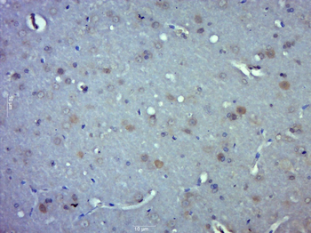 Myosin-4 Rabbit Polyclonal Antibody