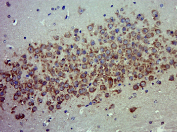 MOB4A Rabbit Polyclonal Antibody