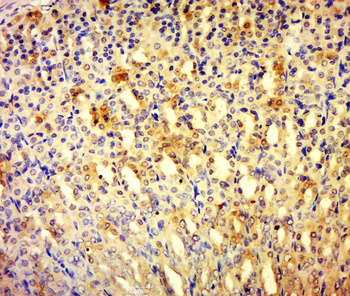 MORN1 Rabbit Polyclonal Antibody