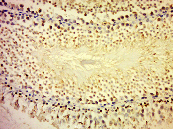 MORN1 Rabbit Polyclonal Antibody