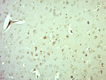 MRPS10 Rabbit Polyclonal Antibody