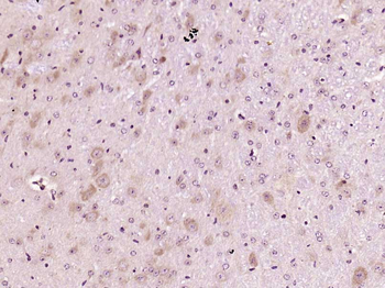 MTO1 Rabbit Polyclonal Antibody
