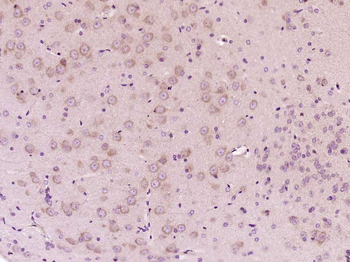 MTO1 Rabbit Polyclonal Antibody
