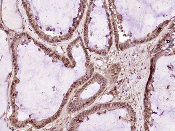 MACROD1 Rabbit Polyclonal Antibody