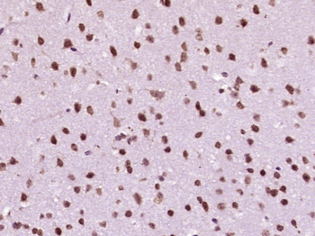 MACROD2/C20orf133 Rabbit Polyclonal Antibody