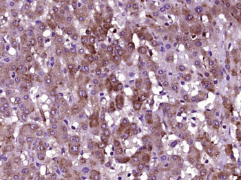 MAGIX Rabbit Polyclonal Antibody