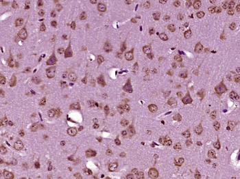 MAGT1 Rabbit Polyclonal Antibody