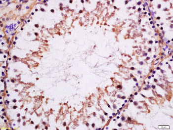Serine/threonine protein kinase MAK Rabbit Polyclonal Antibody