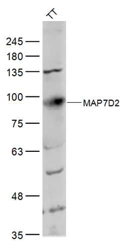 MAP7D2 Rabbit Polyclonal Antibody