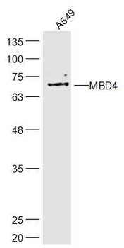 MBD4 Rabbit Polyclonal Antibody