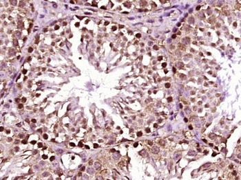 MBD6 Rabbit Polyclonal Antibody