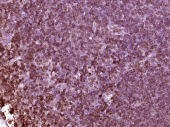 PRDM1 Rabbit Polyclonal Antibody