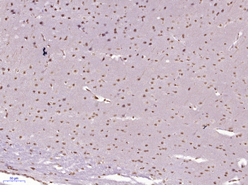 MCAF2 Rabbit Polyclonal Antibody