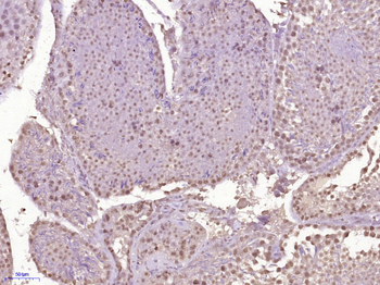 MCAF2 Rabbit Polyclonal Antibody