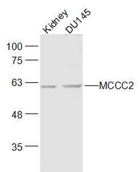MCCC2 Rabbit Polyclonal Antibody