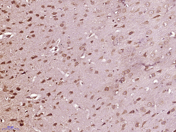 MDM1 Rabbit Polyclonal Antibody