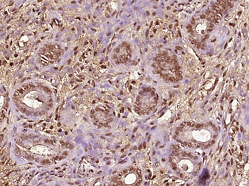 MED18 Rabbit Polyclonal Antibody