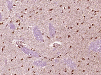 MED29 Rabbit Polyclonal Antibody