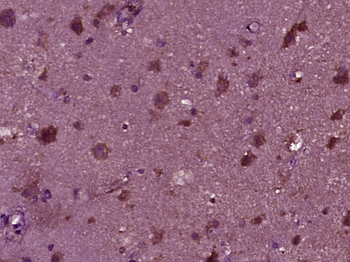 Melanoma Inhibitory Activity Rabbit Polyclonal Antibody