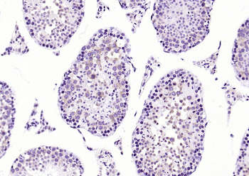 MetAP1 Rabbit Polyclonal Antibody