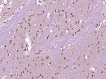 METTL11B Rabbit Polyclonal Antibody