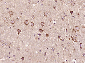 MEX3D/RNF193 Rabbit Polyclonal Antibody