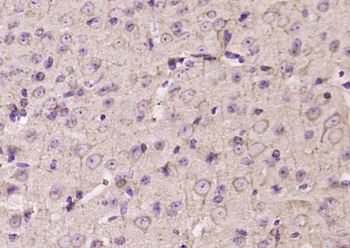 MFSD8 Rabbit Polyclonal Antibody