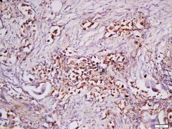 Neuropilin 2/NRP2 Rabbit Polyclonal Antibody