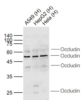 Occludin Rabbit Polyclonal Antibody