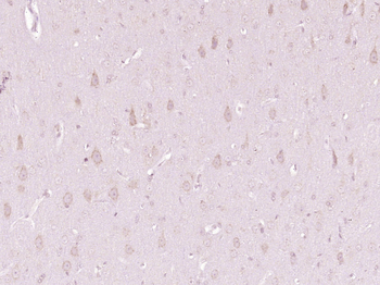 OSBPL11 Rabbit Polyclonal Antibody