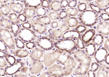 OSBPL9 Rabbit Polyclonal Antibody