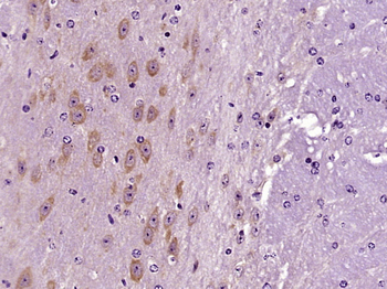 OTUD6B Rabbit Polyclonal Antibody