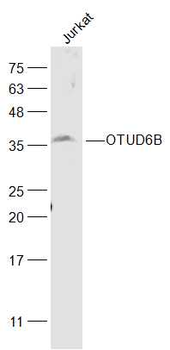 OTUD6B Rabbit Polyclonal Antibody