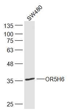 OR5H6 Rabbit Polyclonal Antibody