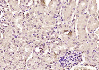 ORC2 Rabbit Polyclonal Antibody