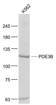PDE3B Rabbit Polyclonal Antibody