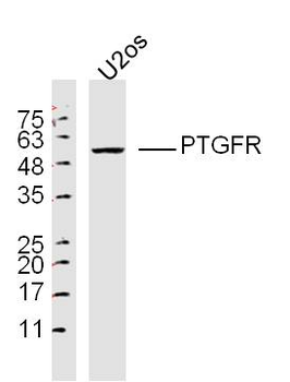 PTGFR Rabbit Polyclonal Antibody