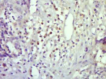 PIP5K2B Rabbit Polyclonal Antibody