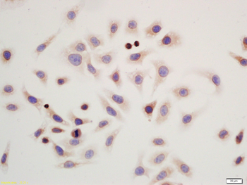 PHB2 Rabbit Polyclonal Antibody