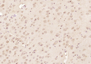 RRAGA + RRAGB Rabbit Polyclonal Antibody