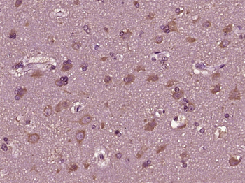 RPS4Y1 Rabbit Polyclonal Antibody