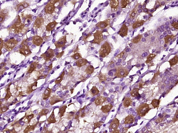 RPS4Y1 Rabbit Polyclonal Antibody